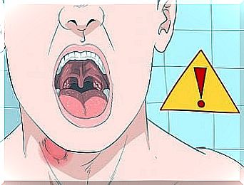 Nodules in the throat