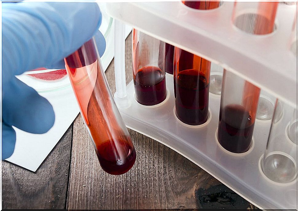 A blood test helps detect cancer in its early stage